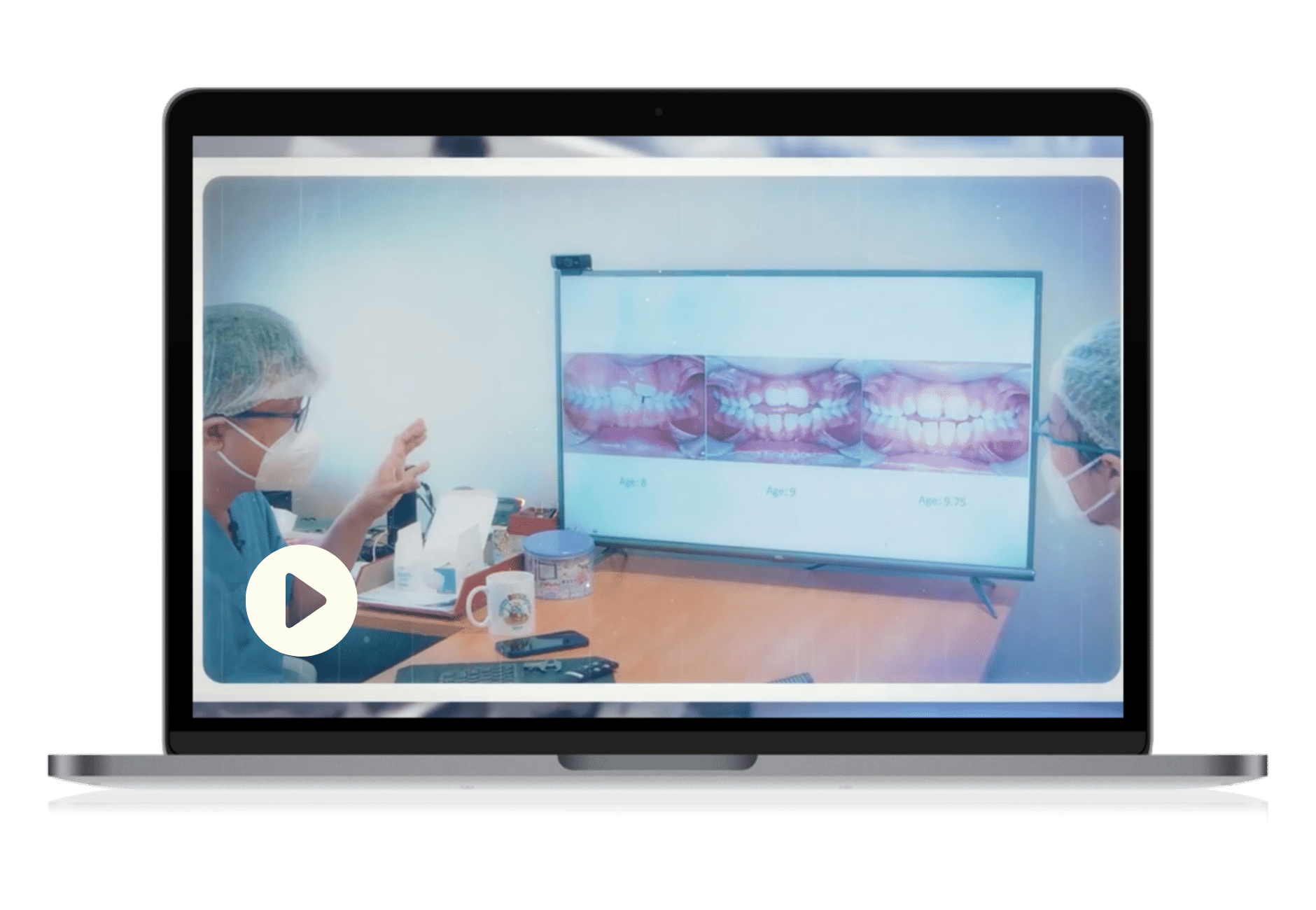 In-depth case review on screen with cephalometric scans