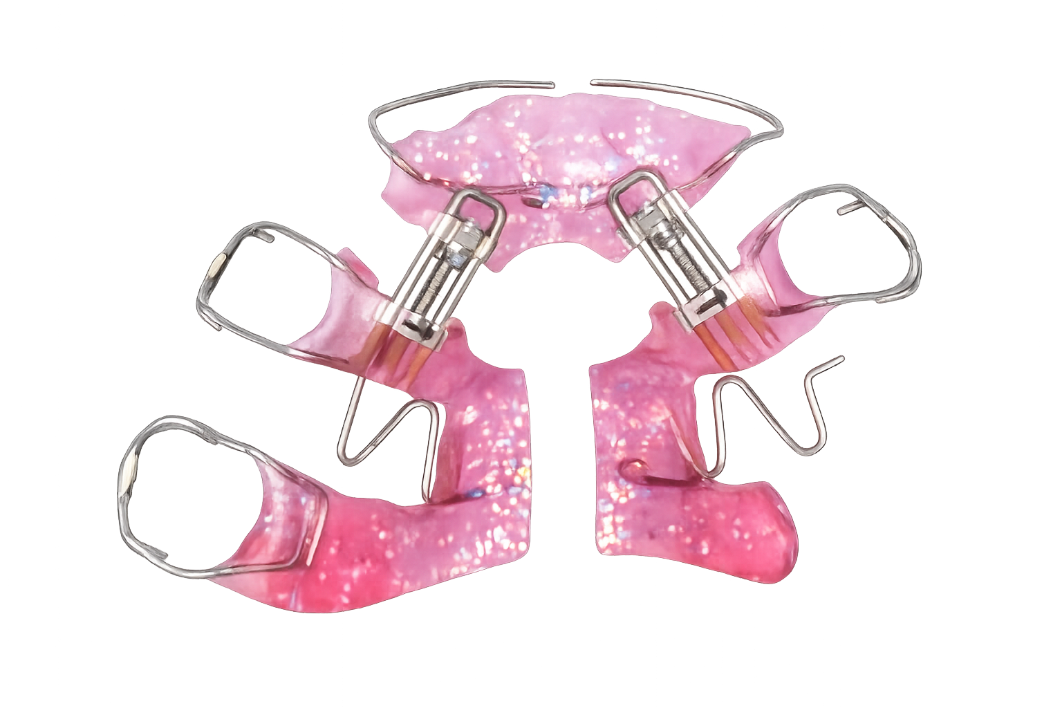 Wong Sagittal expansion appliance